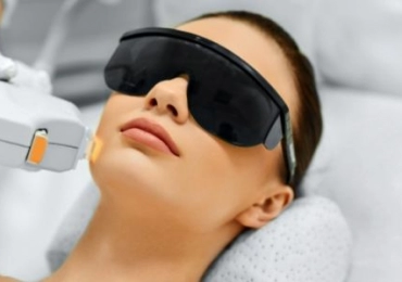 IPL (Intense Pulsed Light) – “Villanófényes” kezelés