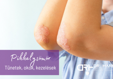 Pikkelysömör