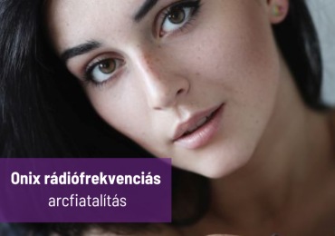 Onix rádiófrekvenciás bőrfiatalító kezelések - arcfiatalítás