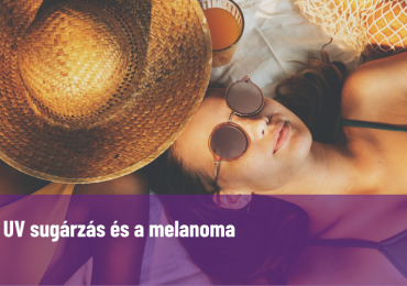 UV sugárzás és a melanoma