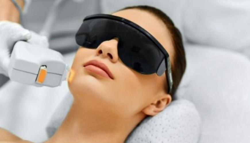 IPL (Intense Pulsed Light) – “Villanófényes” kezelés