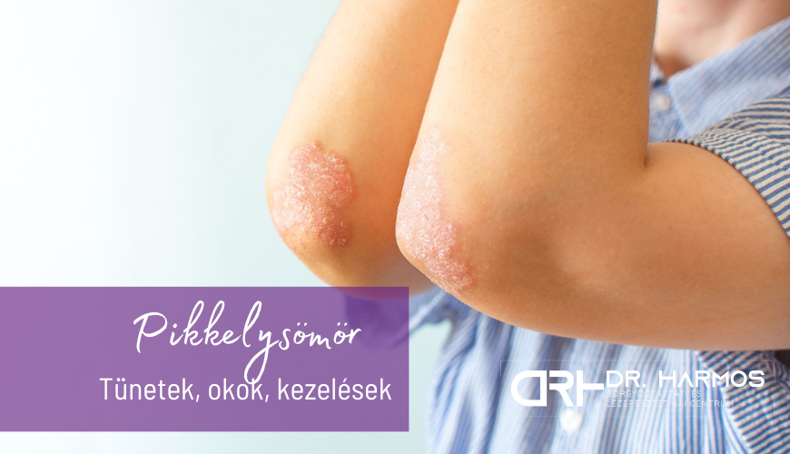 Pikkelysömör